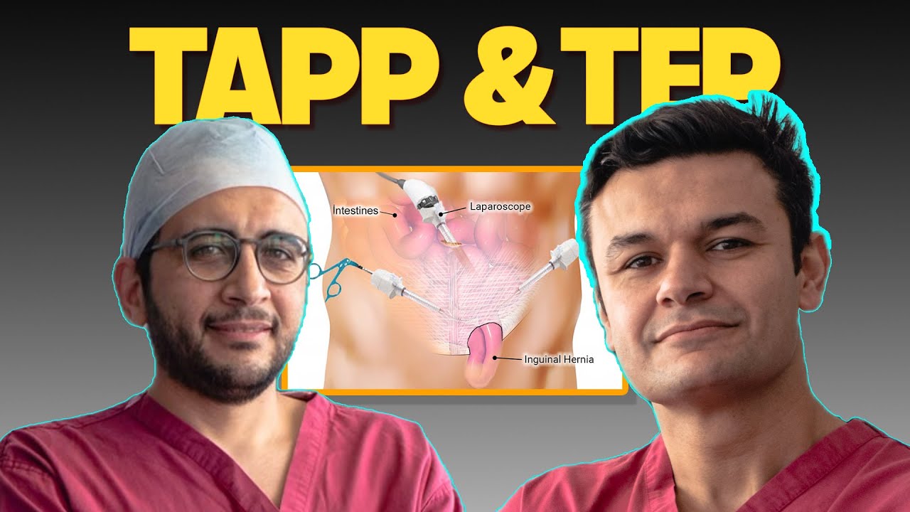 Scrubbing In - Ep5: FRCS Hernia part II - A Detailed Guide to Operative Management