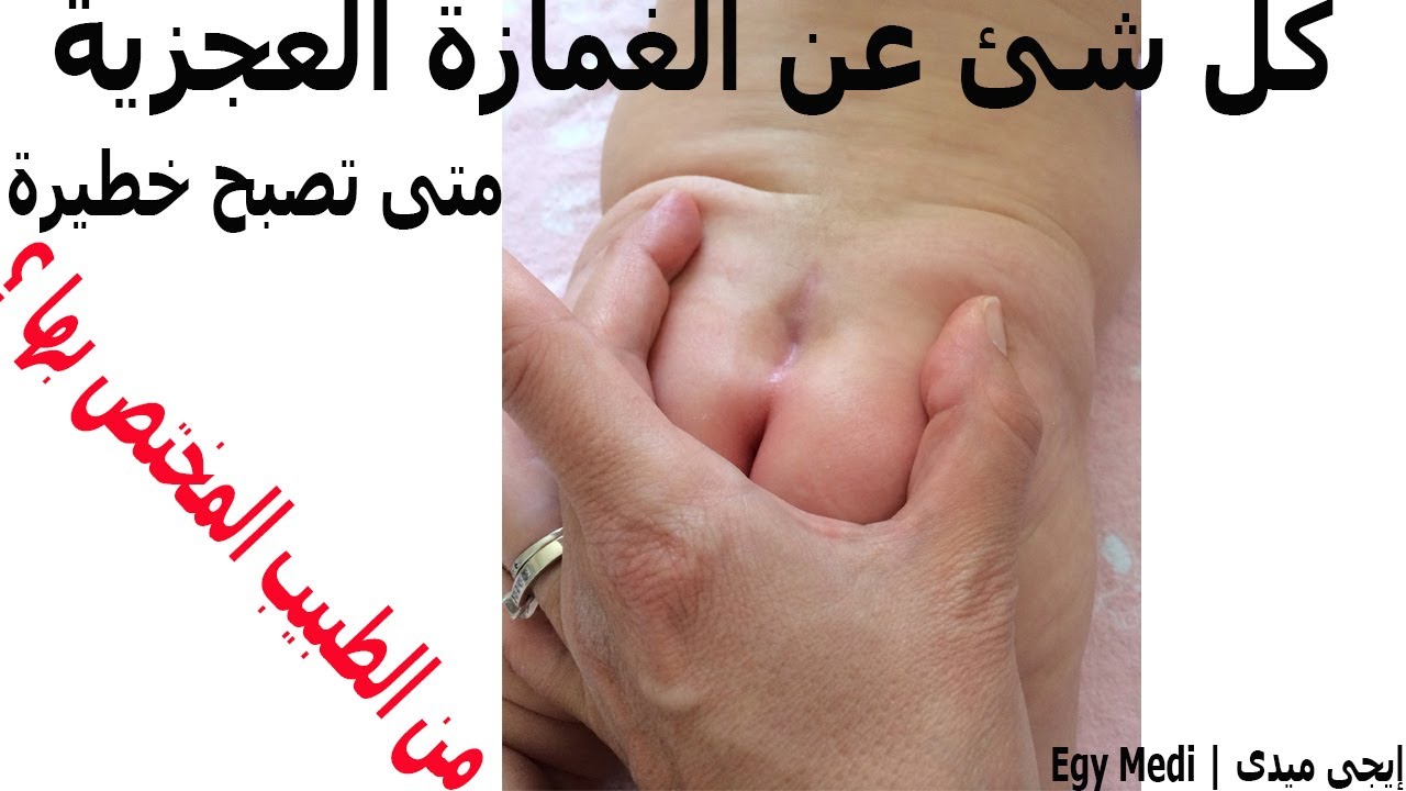 كل شئ عن الغمازه العجزية و متى تصبح خطيرة ؟ و الطبيب المختص بها !