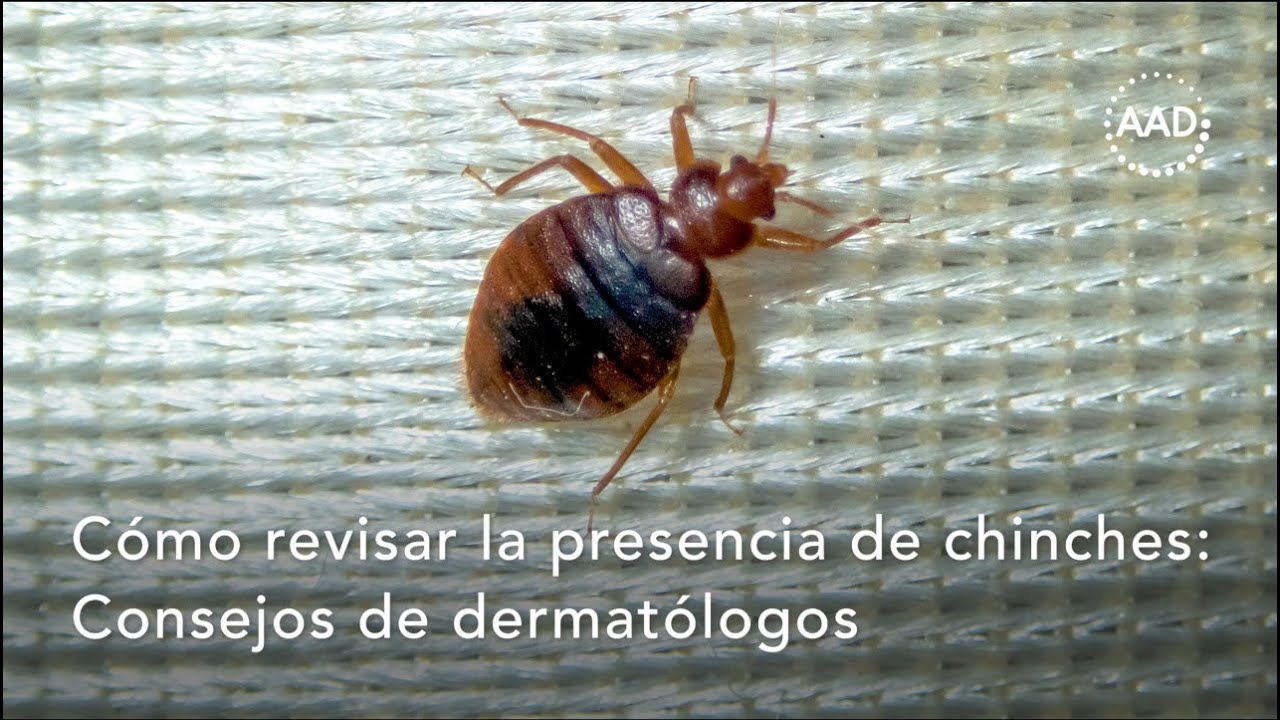 Cómo detectar chinches: Consejos del dermatólogo