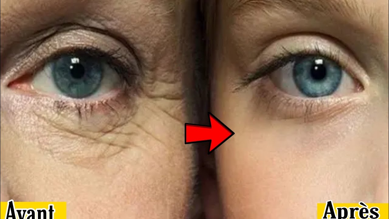 Un secret japonais pour &eacute;liminer les rides des yeux et du visage en une semaine une recette &eacute;prouv&eacute;e
