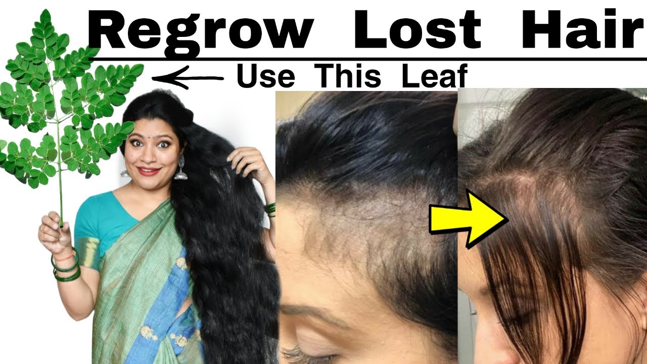 Use This Leaf ( Drink, Oil,Tonic) To Regrow Lost Hair And Hair Line ये पत्ती बालों को वापस उगाये।