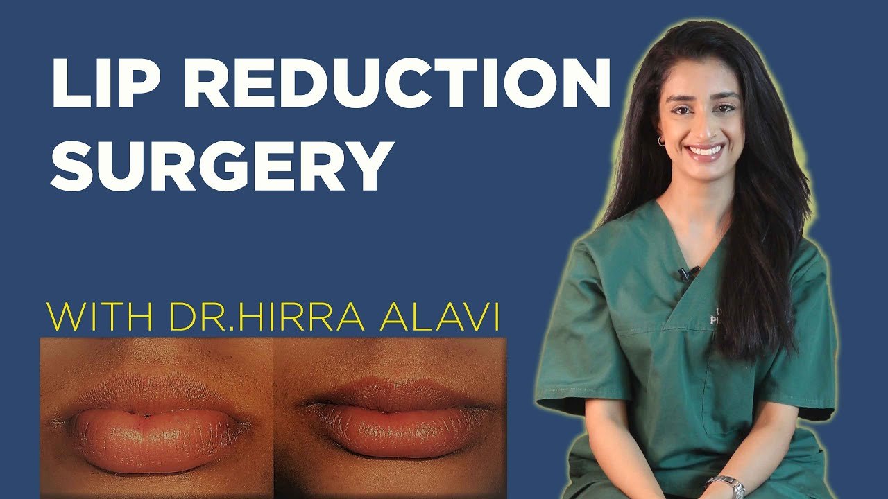 Cosmetic Lip Reduction Surgery | Lip Reduction - Dr.Hirra Alavi