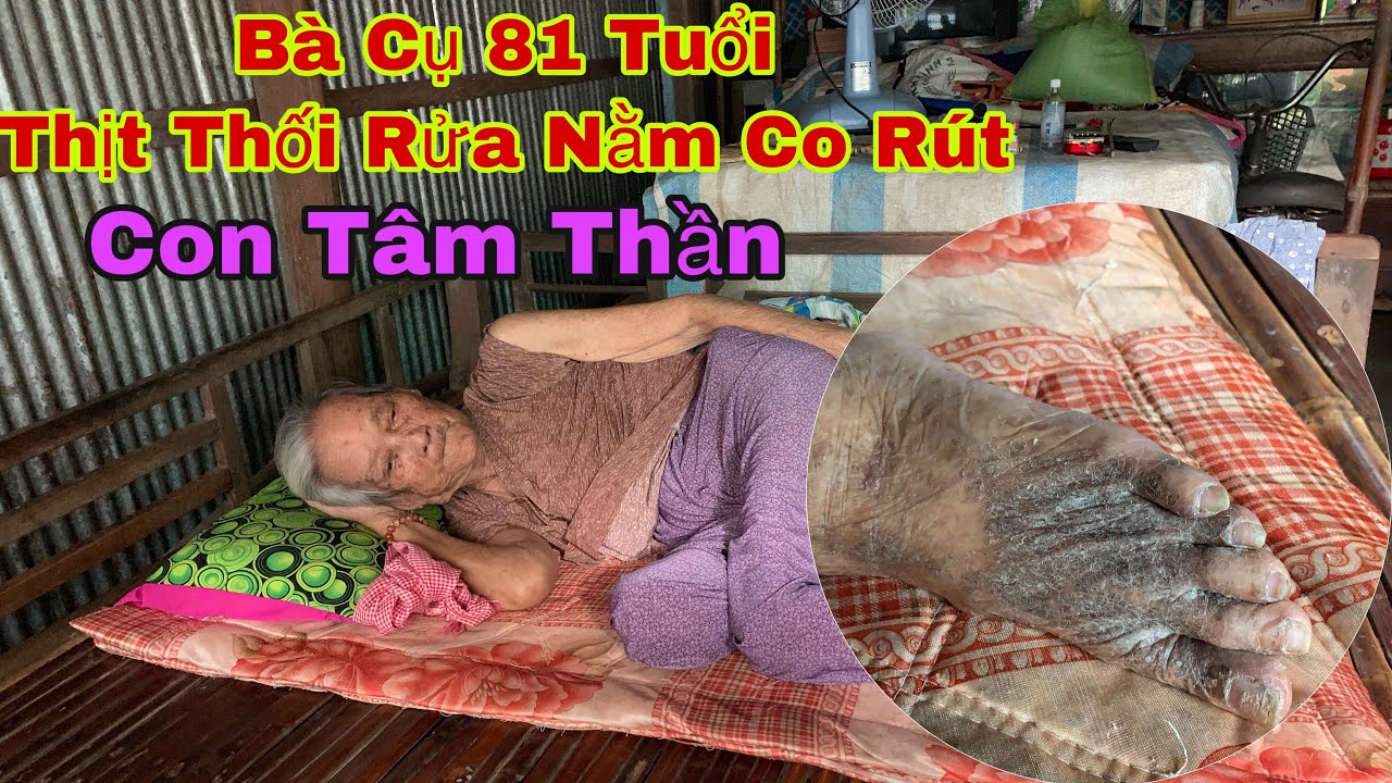 B&agrave; Cụ 81 Tuổi Thịt Thối Rửa Nằm Co R&uacute;t C&ugrave;ng Con T&acirc;m Thần Trong Căn Nh&agrave; Dột N&aacute;t | Chương Đồng Th&aacute;p
