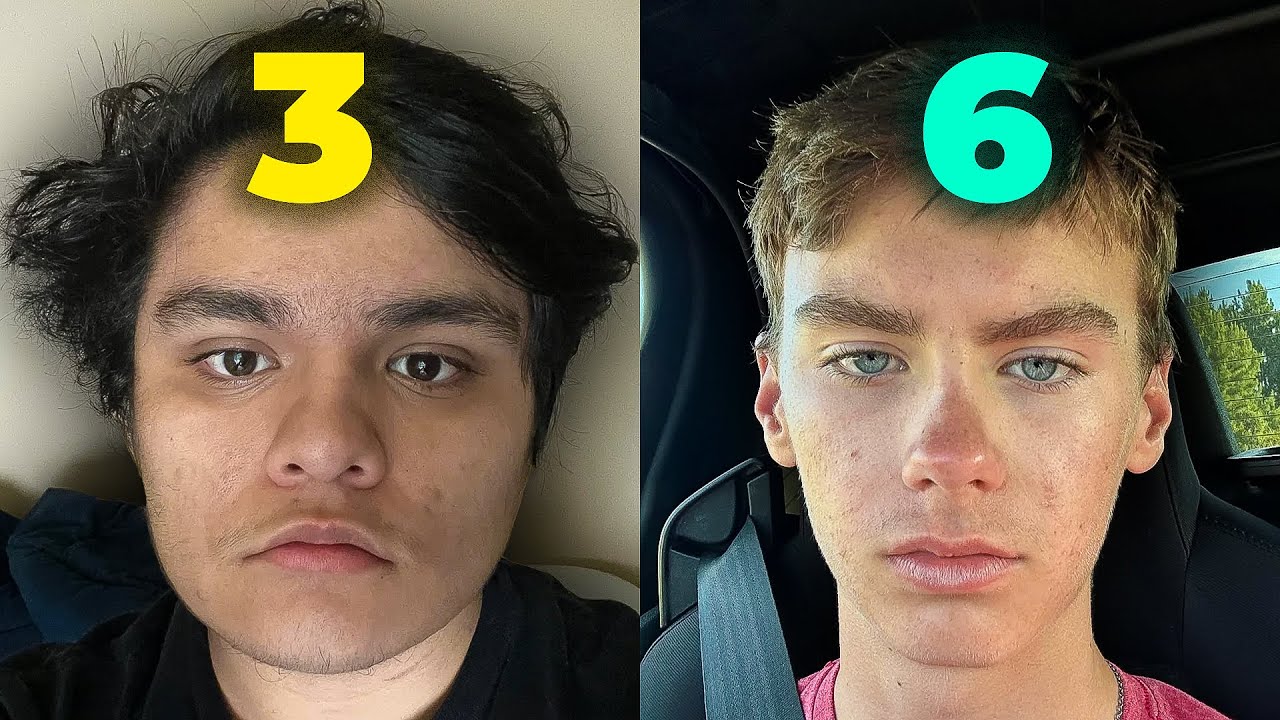 Face Rating + Looksmaxxing Redditors (With Brutal Honesty)