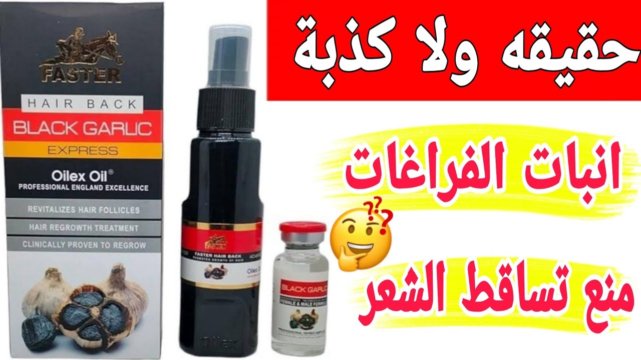 النتيجه صدمه 😳🤔رائي بكل صراحة في اسبراي فاستر ثوم faster لنمو الشعر وانباته يستاهل تجربي ولالا ❌✅
