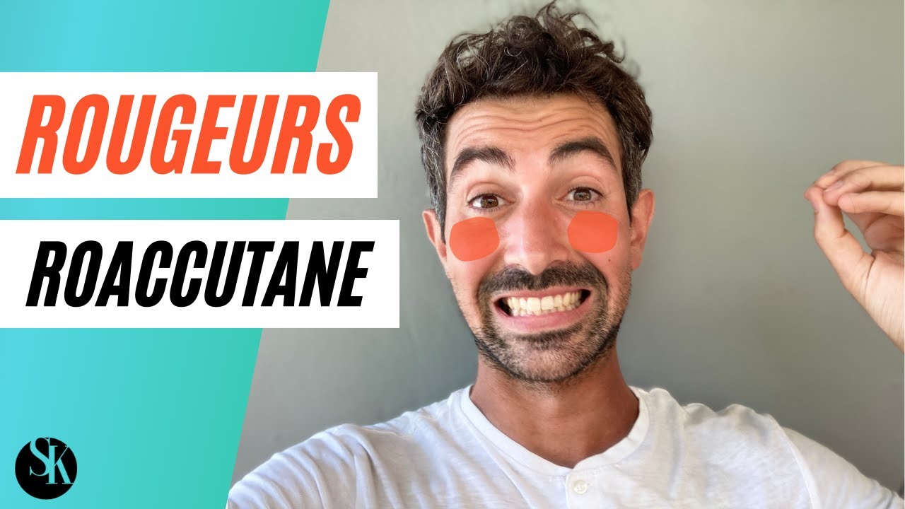 Comment Eviter Les Rougeurs Persistantes Dues Au Roaccutane Flush, Erythrose, Histamine