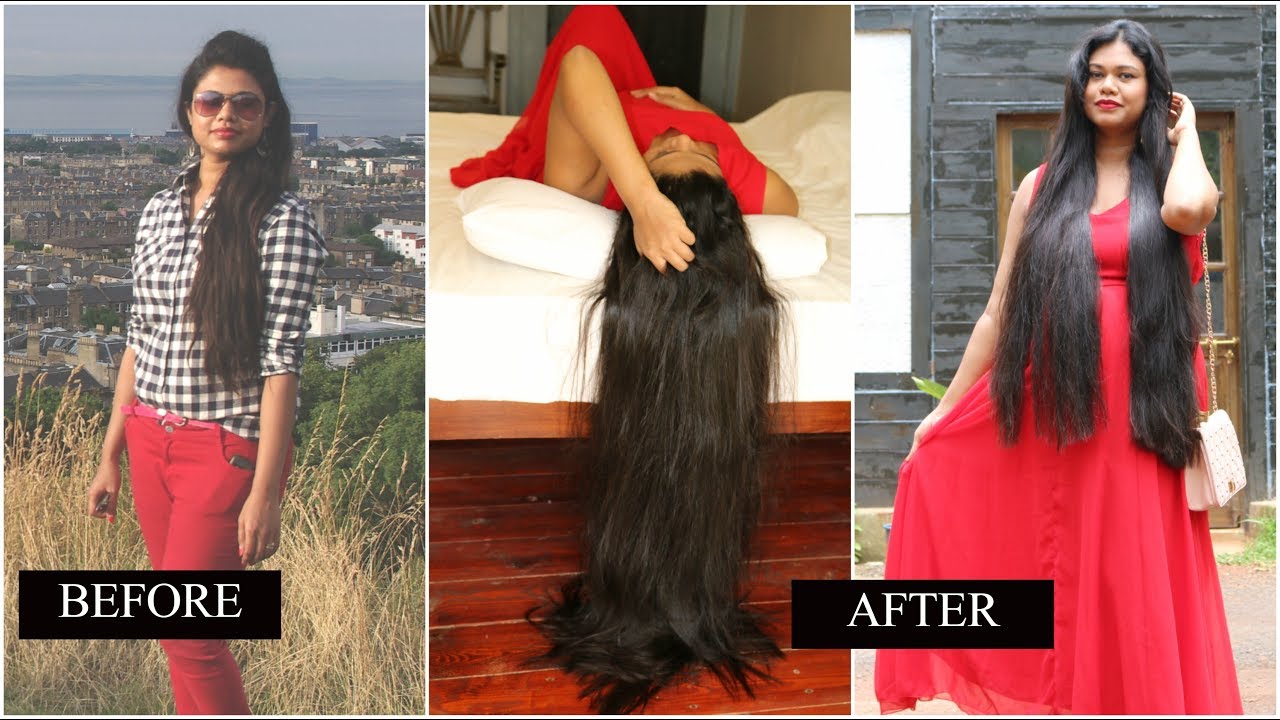 Hair loss: Causes, Symptoms and Treatments using Home Remedies|Sushmita's Diaries