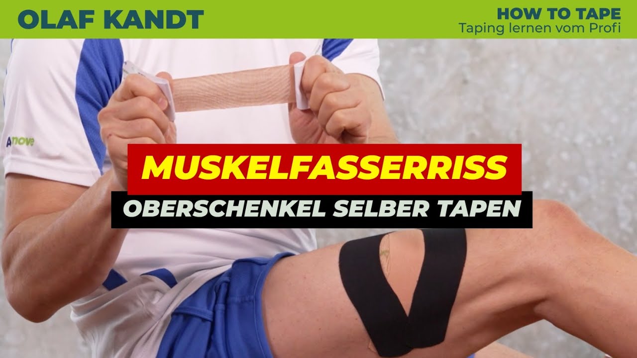 Muskelfaserriss oder Zerrung tapen – schnelle Selbstversorgung bei Muskelverletzung