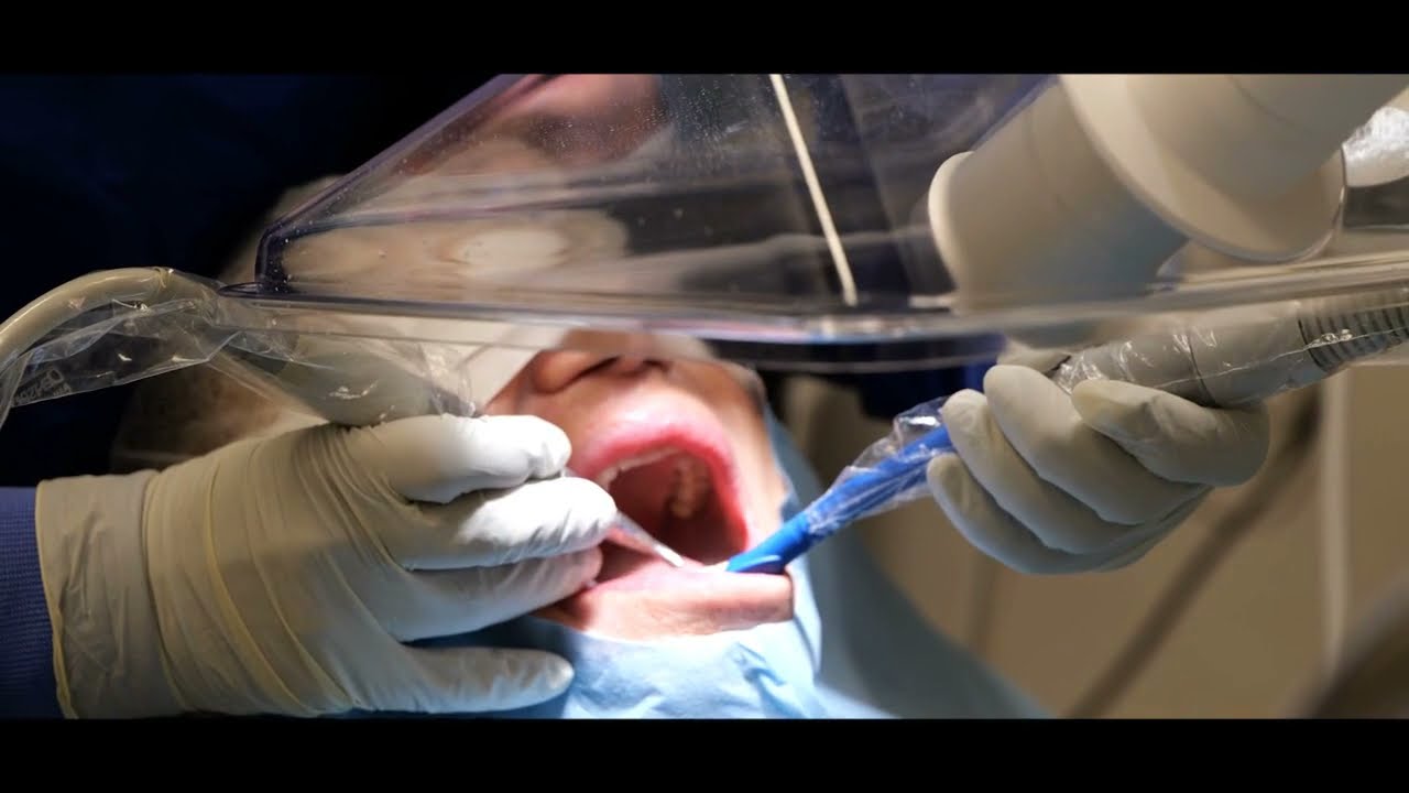 Aspirare in modo efficiente laerosol prodotto durante le procedure do igiene orale