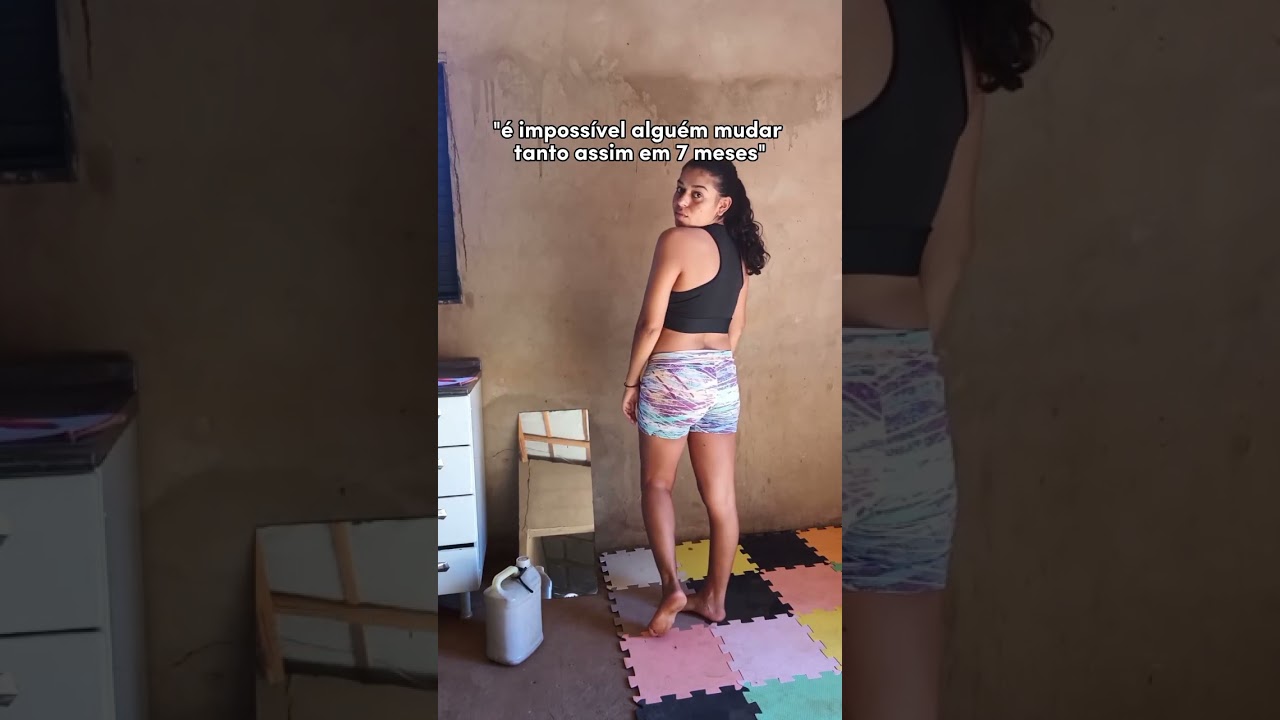 evolu&ccedil;&atilde;o p&oacute;s parto ces&aacute;ria