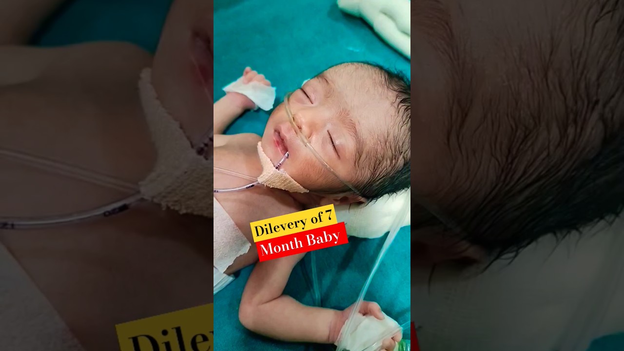 7 month deliver baby 😥 #shorts #viral #trending #nicucare #delevery #preterminfants #prematurebaby