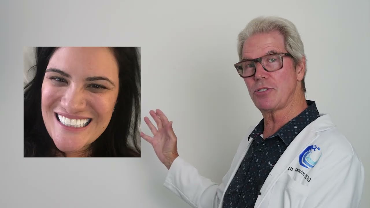 Amazing Smile Transformations Without Surgery or Shaving Teeth