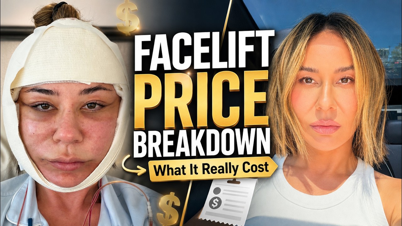 How Much My Deep Plane Facelift REALLY Cost | Full Price Breakdown
