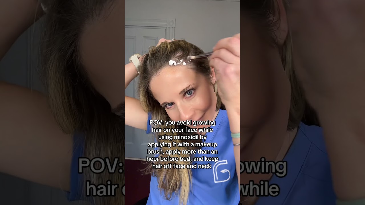 Use minoxidil like this to avoid growing hair on face and neck #hairloss #minoxidil
