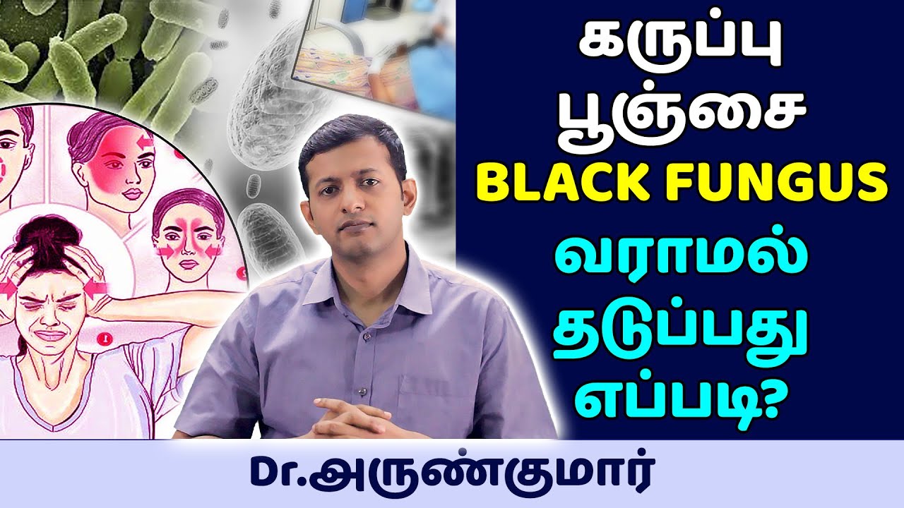 கருப்பு பூஞ்சை – BLACK FUNGUS – MUCORMYCOSIS – வராமல் தடுப்பது எப்படி? | Dr. Arunkumar