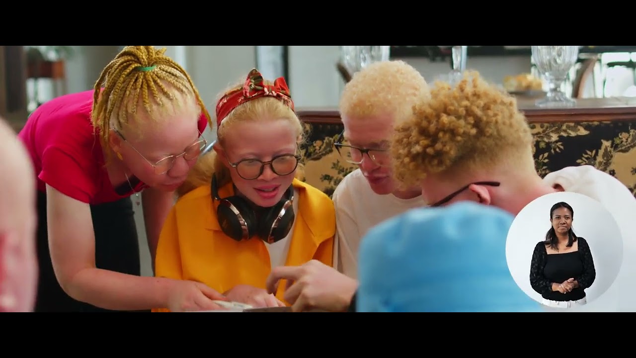 ZAHAY OLOMBELO - ALBINOS