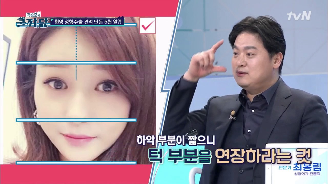 [티안나] 현영 성형수술 예상 견적은?