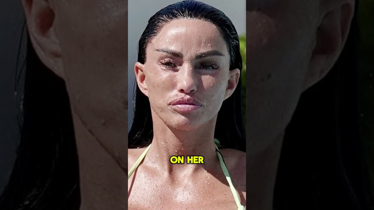 Katie Price’s Most Painful Surgery Revealed  