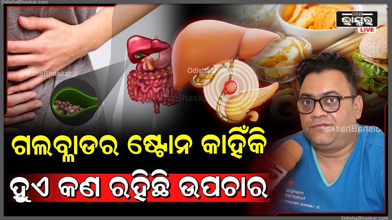 ଗଲବ୍ଳାଡର ଷ୍ଟୋନ କାହିଁକି  ହୁଏ ଓ ଏହାର  କଣ ରହିଛି ଉପଚାର ? Gall Bladder Stone and Its Treatment