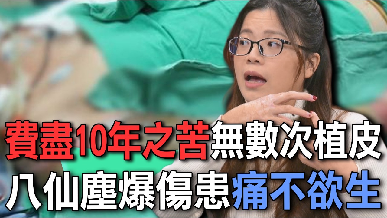費盡10年之苦無數次植皮  八仙塵爆傷患痛不欲生【新聞挖挖哇】