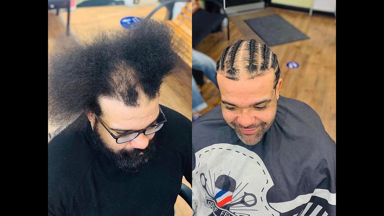 HOW TO BRAID OVER BALD PATCHES FOR BEGINNERS 🔝
