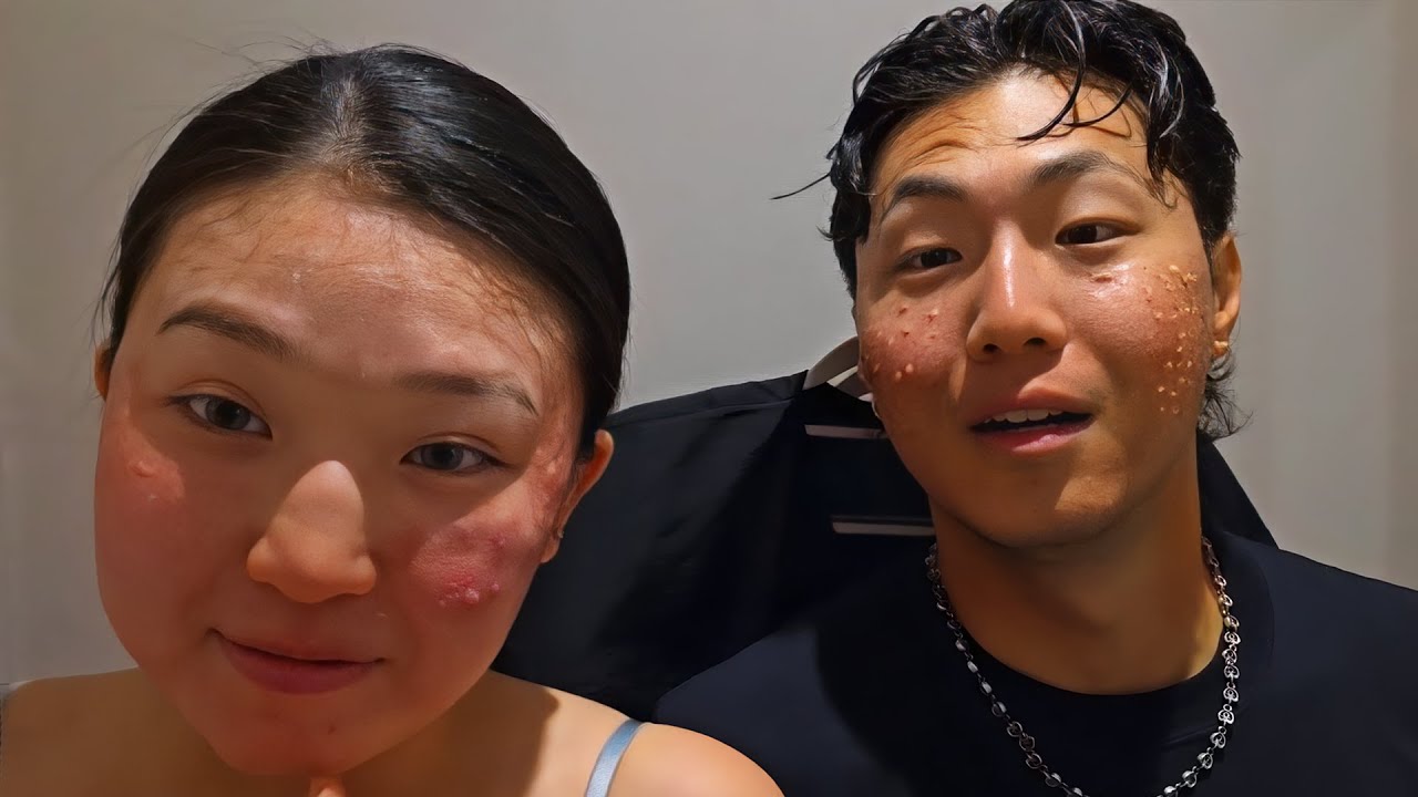 $10,000 Salmon Sperm Facial… We Looked UNHINGED After 😭