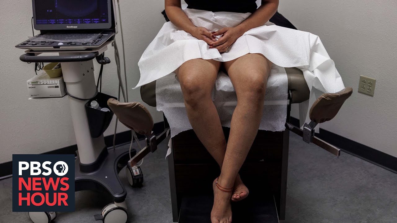 Study estimates 64,000 pregnancies from rape in states that enacted abortion bans post-Roe