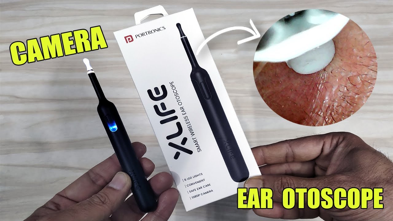 Best Ear Otoscope Camera? HD Visual Inspection & Earwax Removal!