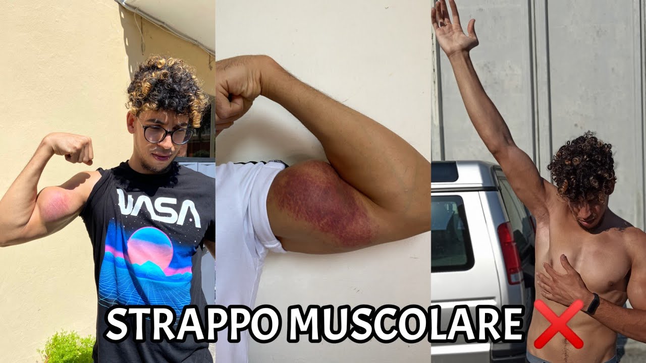 COME STO RECUPERANDO DALLO STRAPPO MUSCOLARE