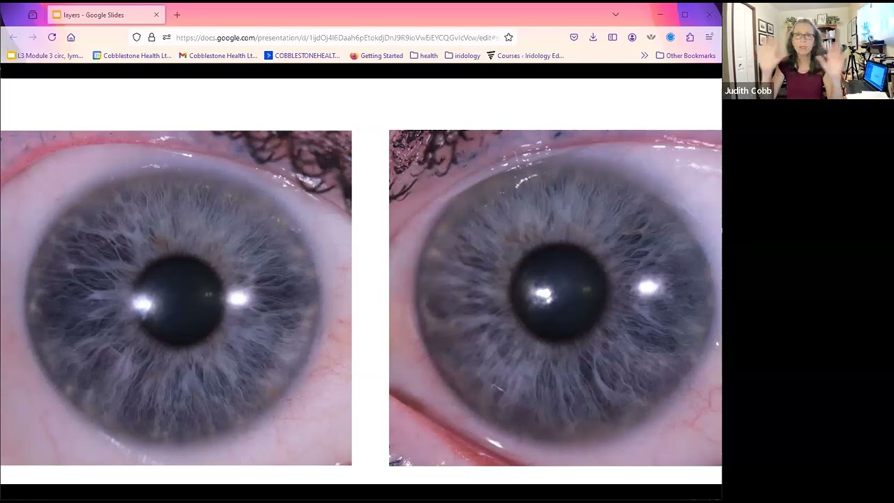 How to do an iris assessment