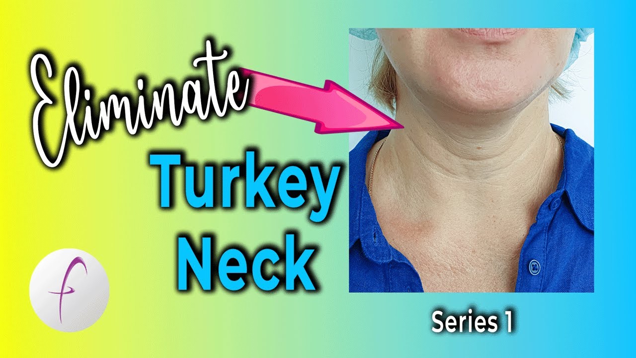 Do this Daily to Tighten & Tone TURKEY NECK and NECK LINES