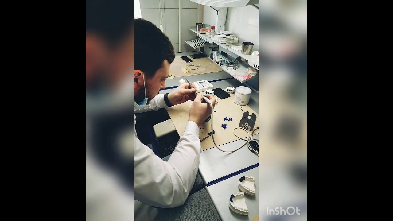 Литье в стоматологии. Основы