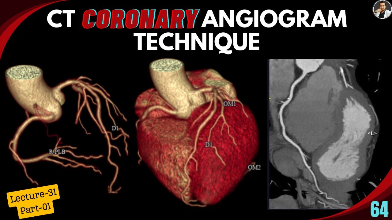 CT CORONARY ANGIOGRAM TECHNIQUE - Part-01 | Blood Supply | Indication | ECG gating | Preparation |