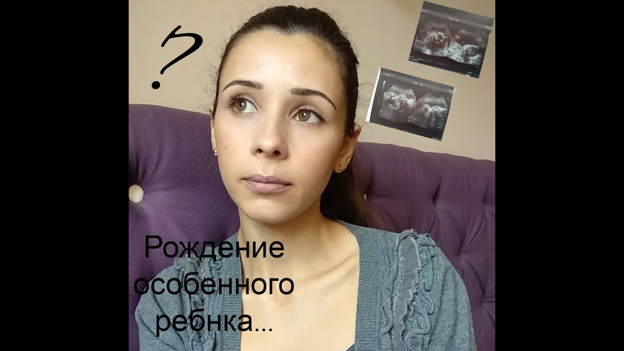 Рождение особенного ребенка/ Беременность с угрозами/ Расширенные желудочки ГМ у плода/ ВПР ЦНС