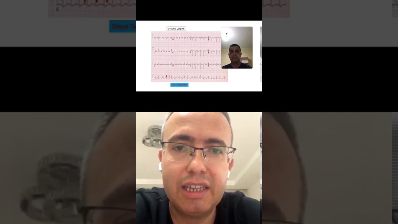 “Terminal Ritme Doğru Geri Sayım, Disritmilerin EKG’de Yorumlanması” - Part 1