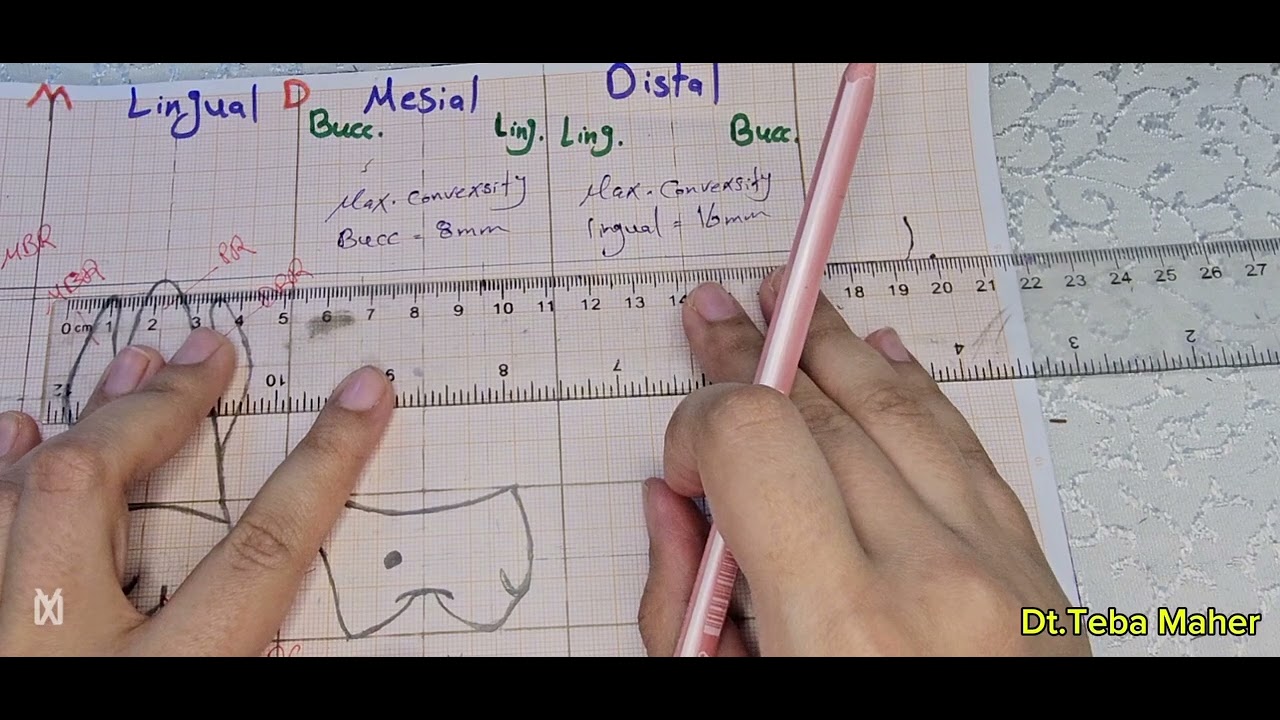 Drawing Maxillary First Molar (Mesial and Distal surface) part 2