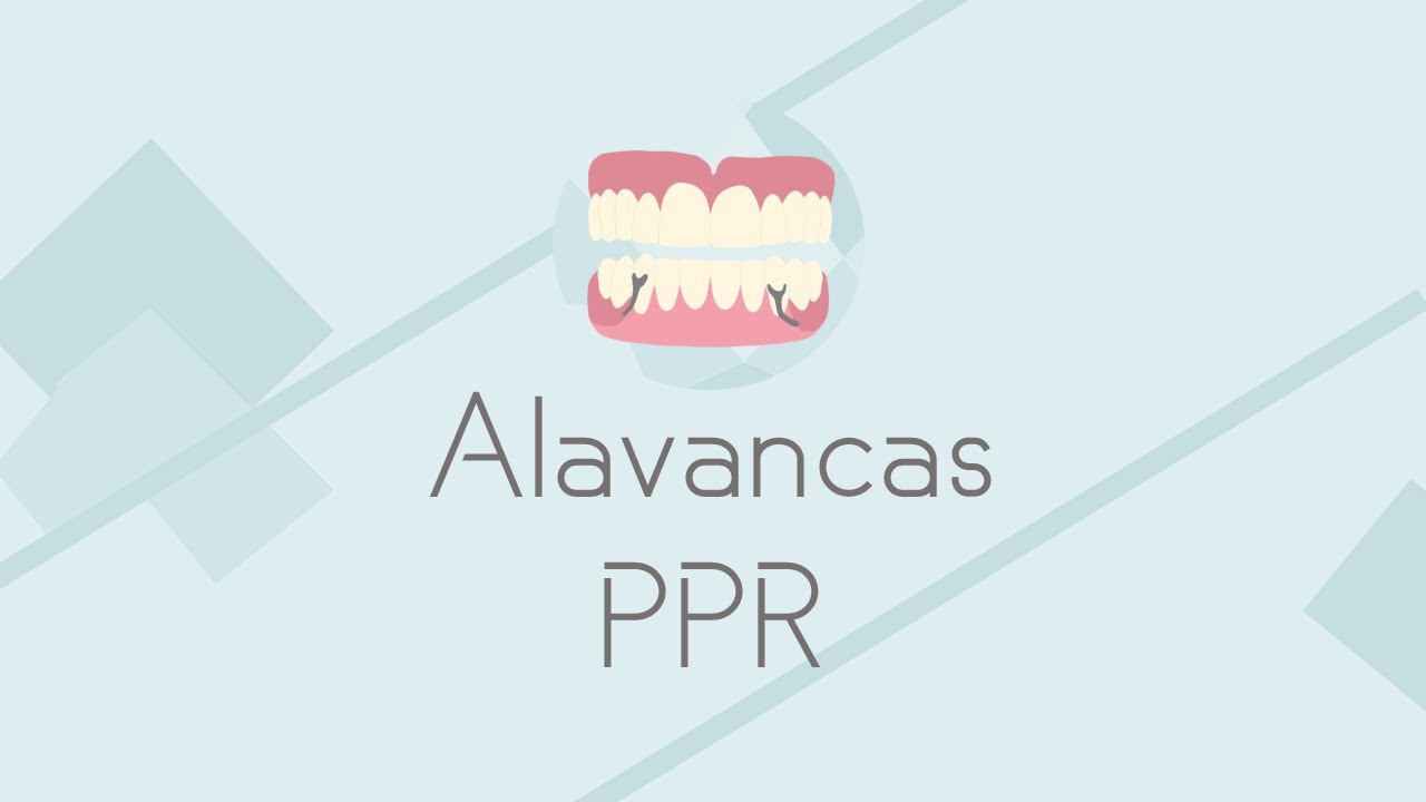 Biomecânica: sistema de alavancas (PPR)