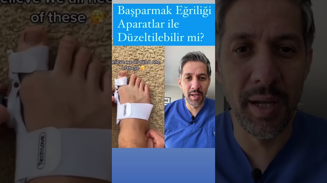 Başparmak Eğriliği ( Halluks Valgus) Atel ile Düzeltilebilir mi?