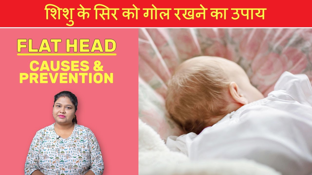 Flat Head in Babies: Causes and Prevention
