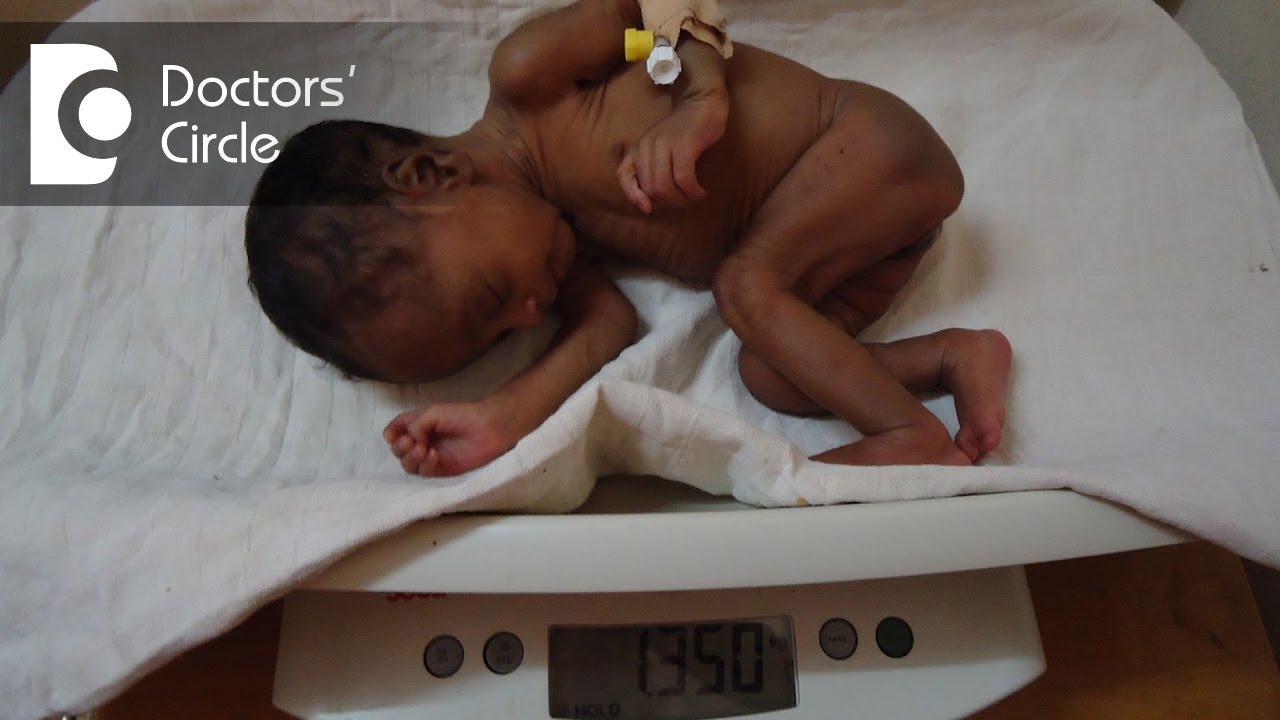 What causes low birth weight? - Dr. Teena S Thomas