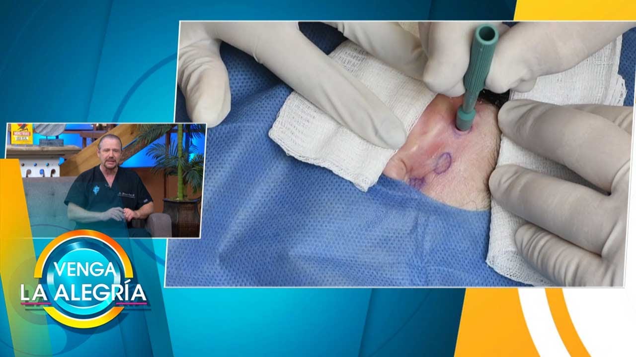 Cultivo de fibroblastos. ¿Para qué funciona? El Dr. Giovanni Betty nos lo dice, | Venga La Alegría