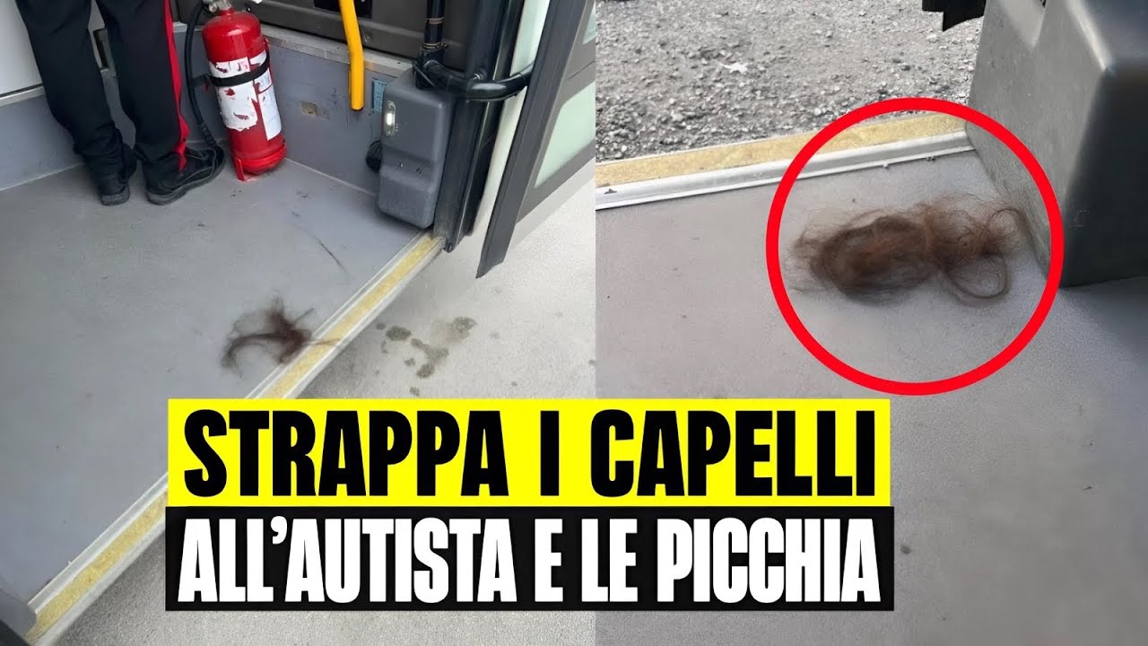 ORRORE SUL BUS: AUTISTA CHIEDE IL BIGLIETTO A UNA RAGAZZA. LEI LE STRAPPA I CAPELLI E LA PICCHIA