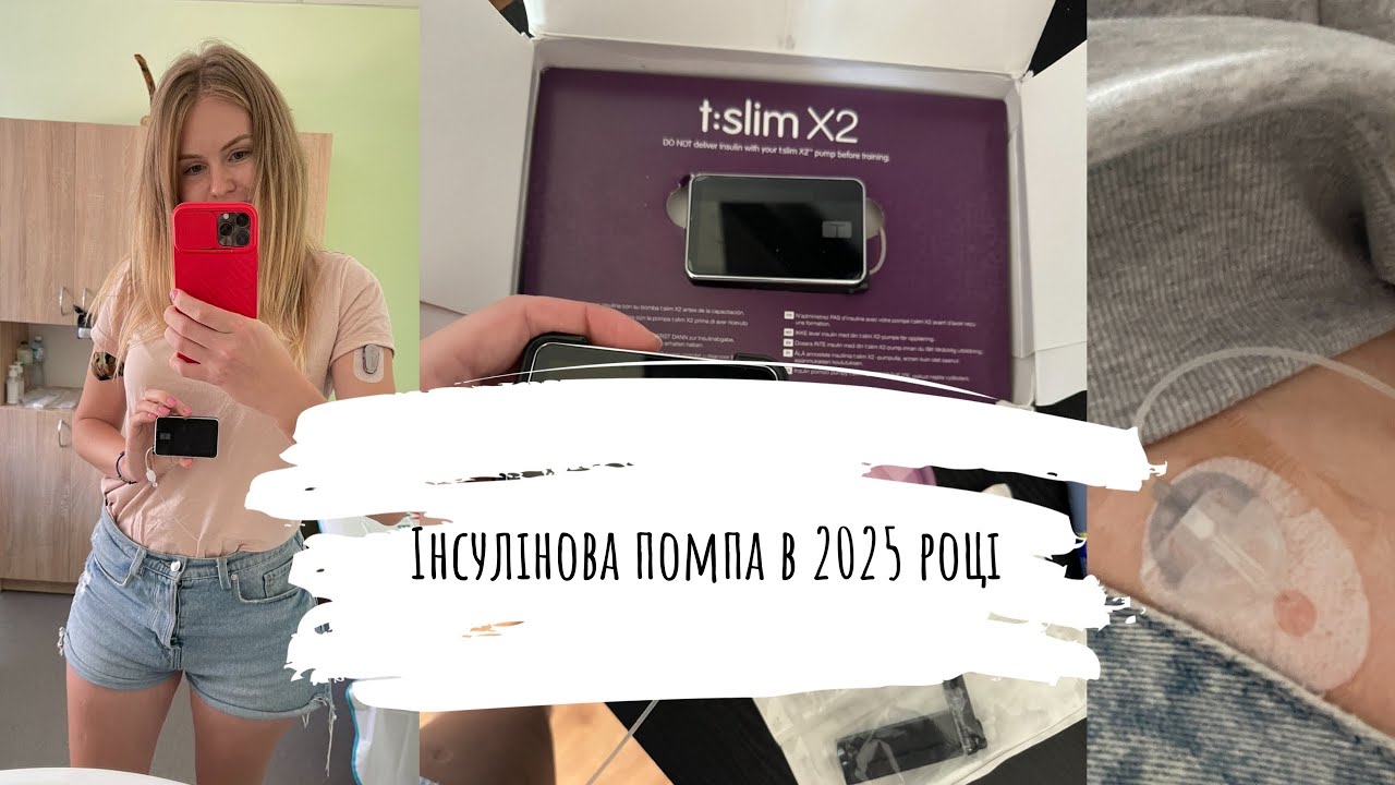 Інсулінова помпа в 2025 році? Розумна сенсорна помпа Тандем