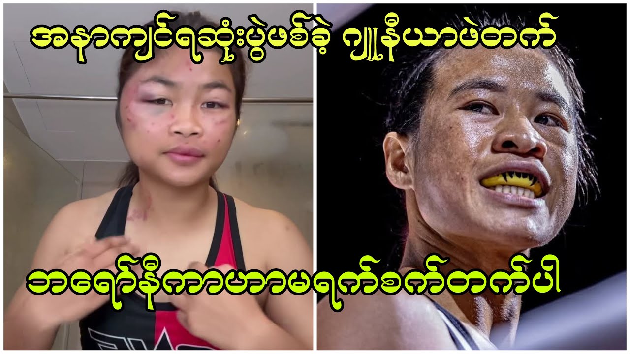 ဘရော်နီကာဟာ ပြိုင်ဘက်အပေါ်မရက်စက်တက်ပါ