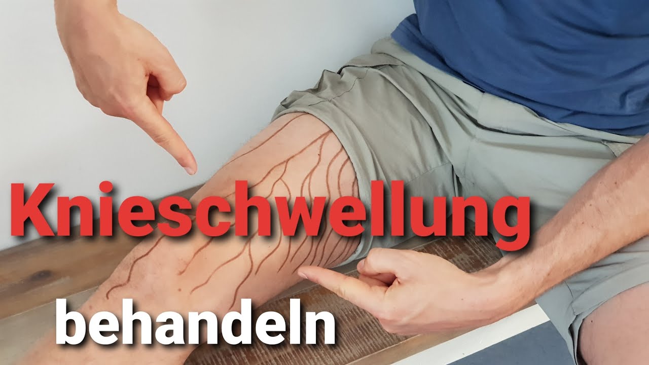 Knieschwellung: Lymphdrainage am Knie SELBER machen (Physio zeigt SOFORT-ÜBUNG)