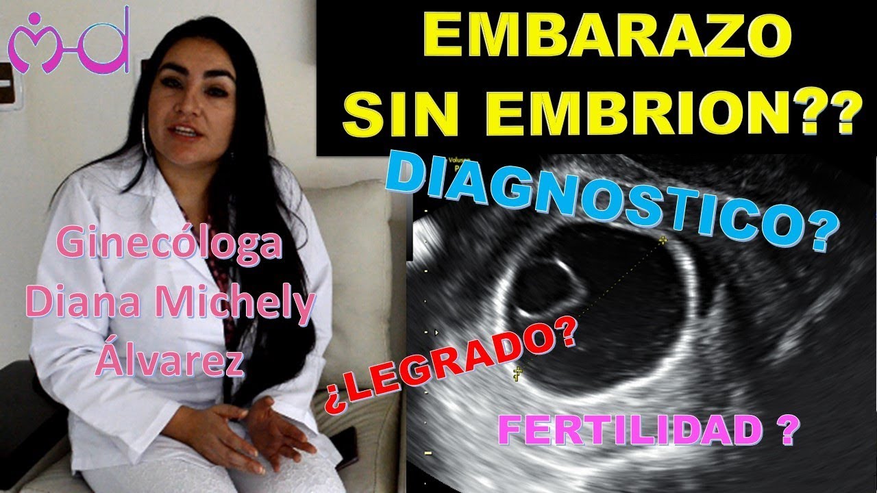EMBARAZO ANEMBRIONADO; POR GINECOLOGA DIANA ALVAREZ