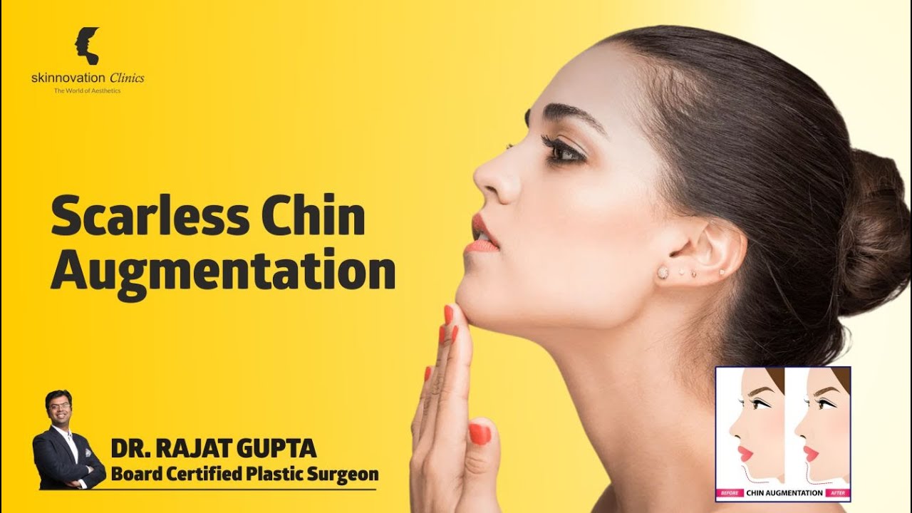 Scarless Chin Augmentation | Chin implant surgery in India | Dr Rajat Gupta - Skinnovation Clinics