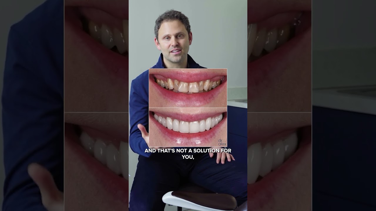 3 Main Reasons People Get Porcelain Veneers