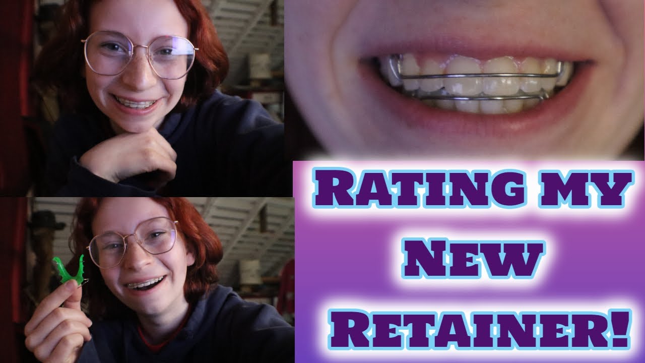 Rating my New Retainer || Pros and cons