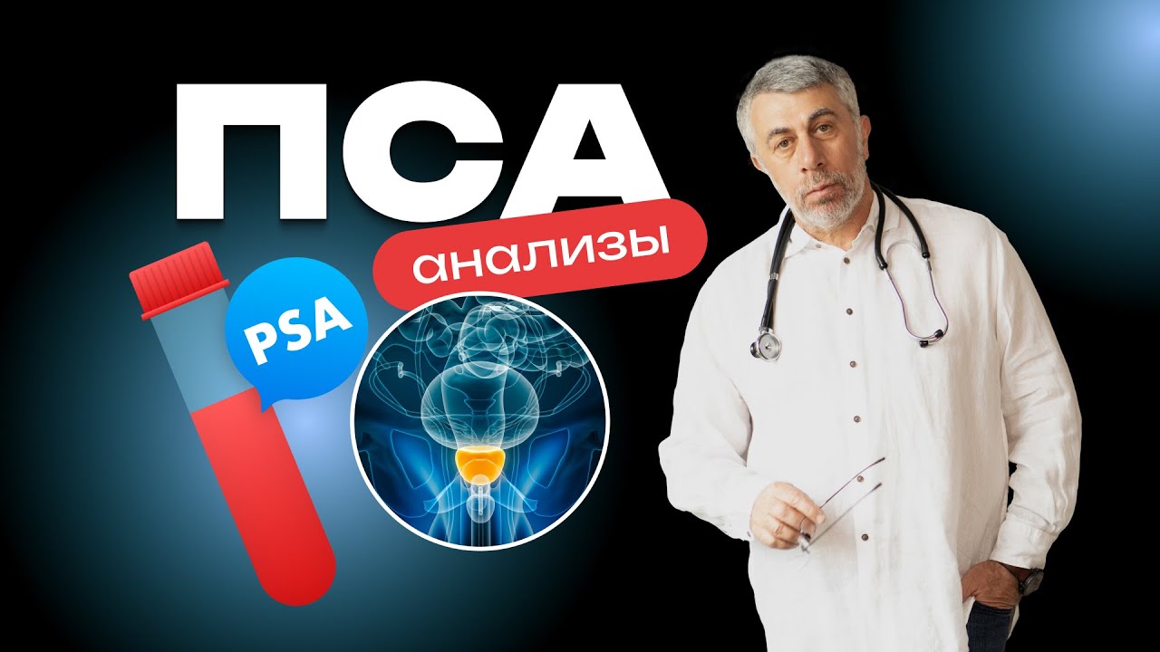 Анализ на ПСА: кому, когда и как сдавать. Что делать с результатом?